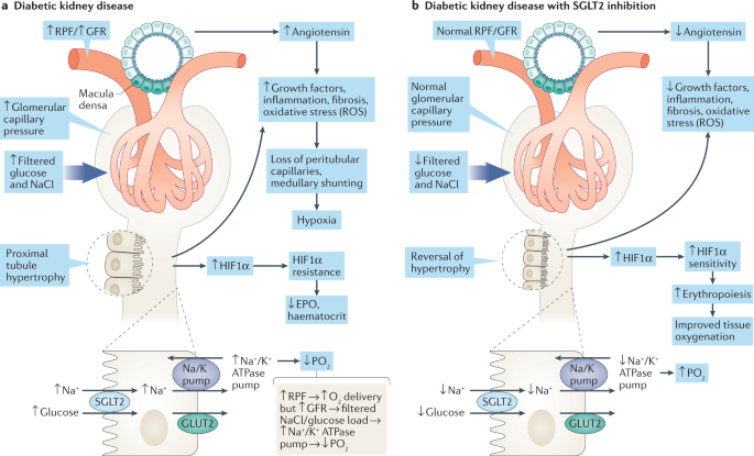 renal disease secondary to diabetes