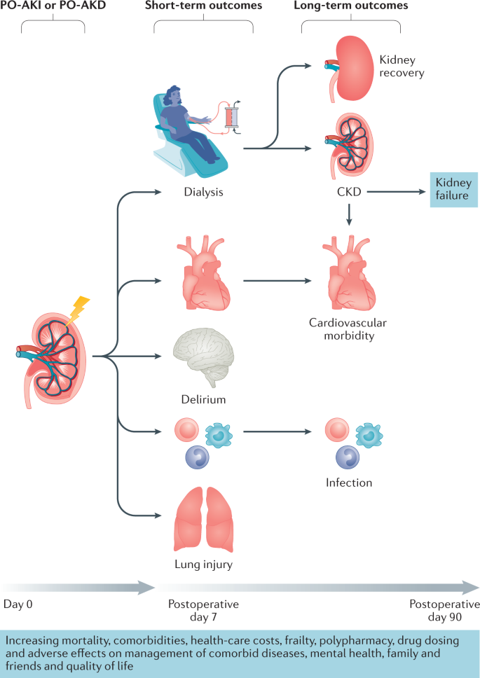 Postoperative acute kidney injury in adult non-cardiac surgery: joint  consensus report of the Acute Disease Quality Initiative and PeriOperative  Quality Initiative | Nature Reviews Nephrology