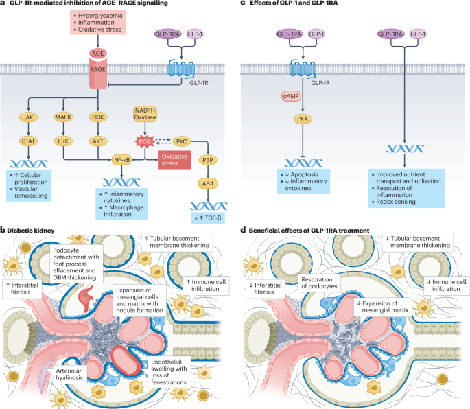 GLP-1 receptor agonists and next-generation metabolic hormone therapies in  chronic kidney disease