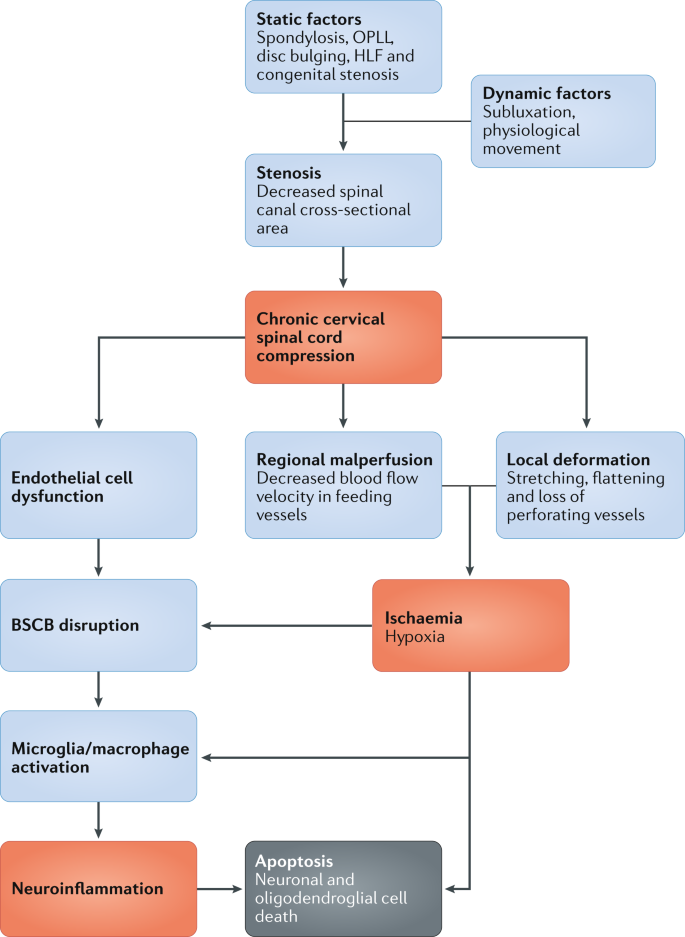 Degenerative Cervical Myelopathy Update And Future Directions Nature Reviews Neurology Degenerative Cervical Myelopathy Update And Future Directions Nature Reviews Neurology