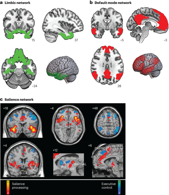 Psychiatric sequelae of traumatic brain injury — future directions