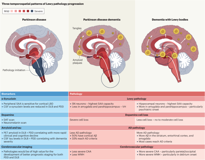 dementia-with-lewy-bodies-and-parkinson-disease-dementia-the-same-or