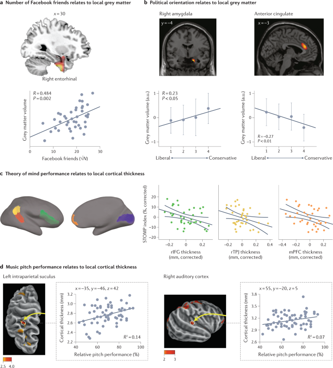 Brain and Behavior: Vol 13, No 9