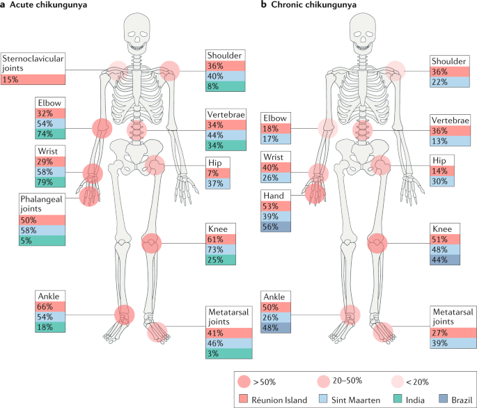 arthralgia myalgia definition artrita reumatoidă a simptomelor mâinilor