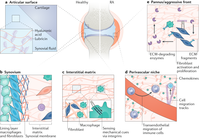 Location Location Location How The Tissue Microenvironment Affects Inflammation In Ra Nature Reviews Rheumatology