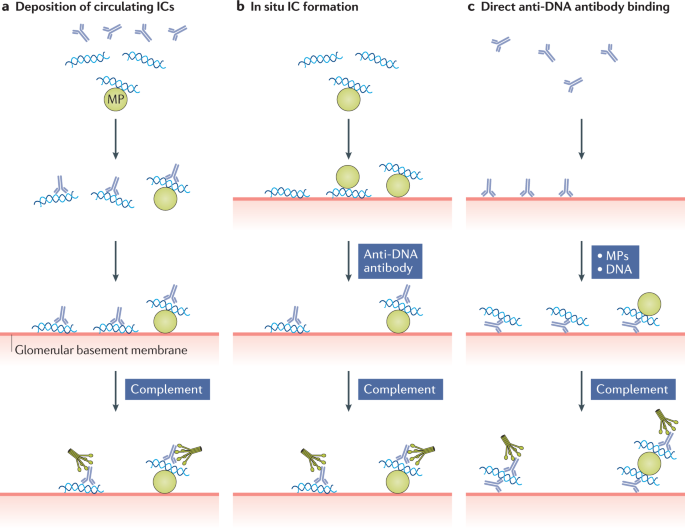 systemic lupus erythematosus