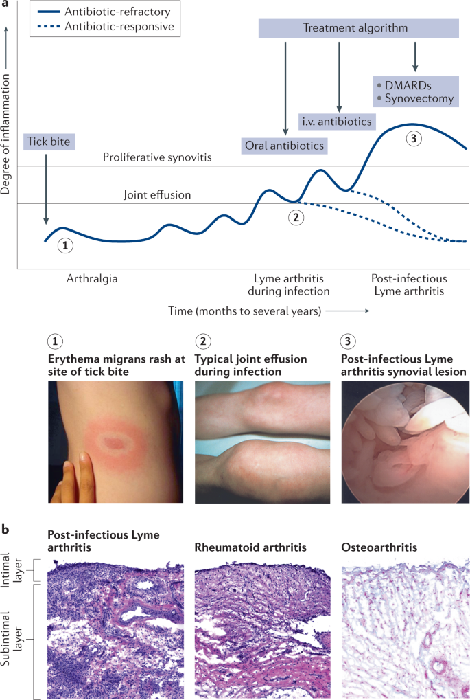 glutathione injection marylebone Mitogive Glutathione IV