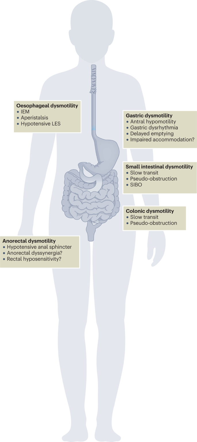 Gastrointestinal Myoelectrical Activity in Idiopathic Intestinal  Pseudo-Obstruction