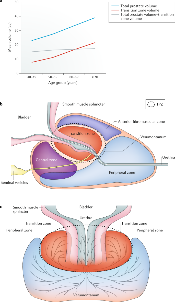 Prostatitis és otch prostate gland histology