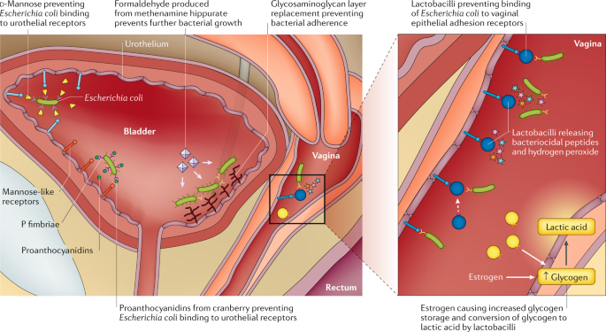 Nonantibiotic prevention and management of recurrent urinary tract infection  | Nature Reviews Urology