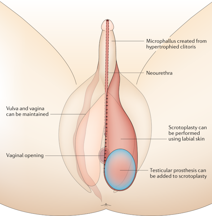 Supporting sexuality and improving sexual function in transgender persons |  Nature Reviews Urology