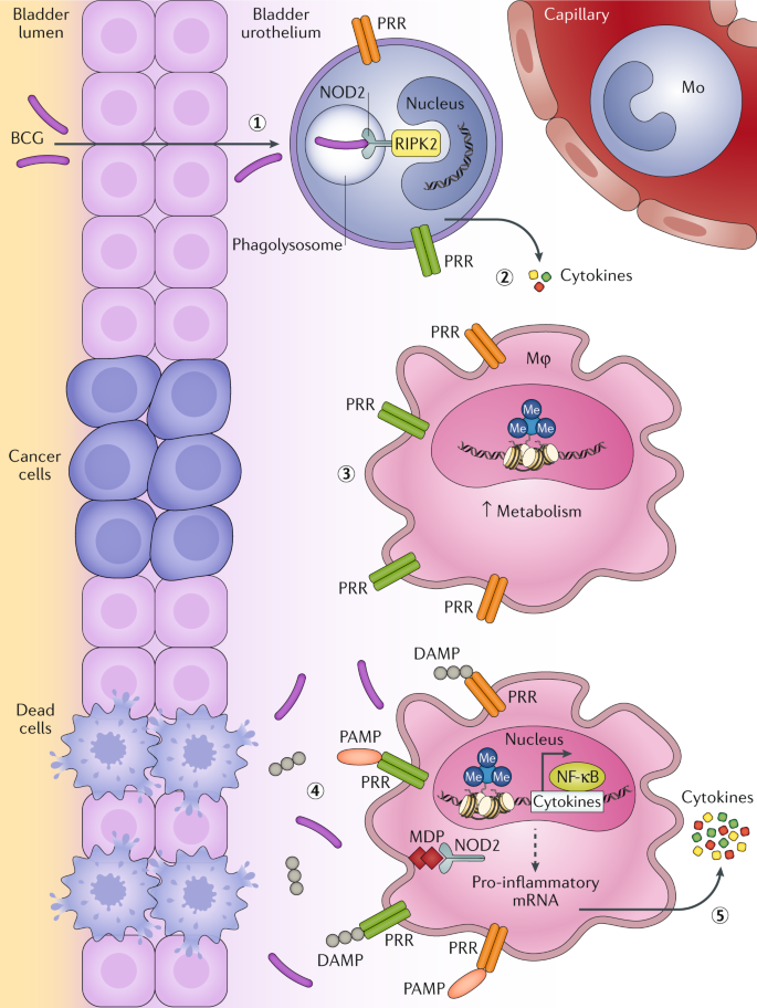 Trained immunity as a molecular mechanism for BCG immunotherapy in bladder  cancer | Nature Reviews Urology