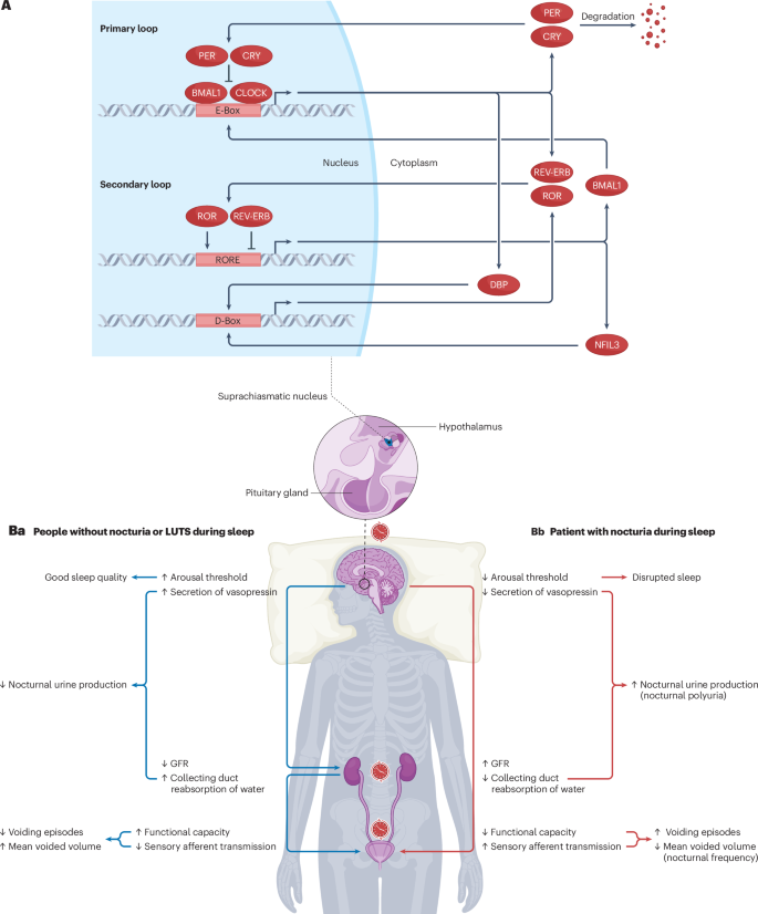 Disruption of circadian rhythm as a potential pathogenesis of 