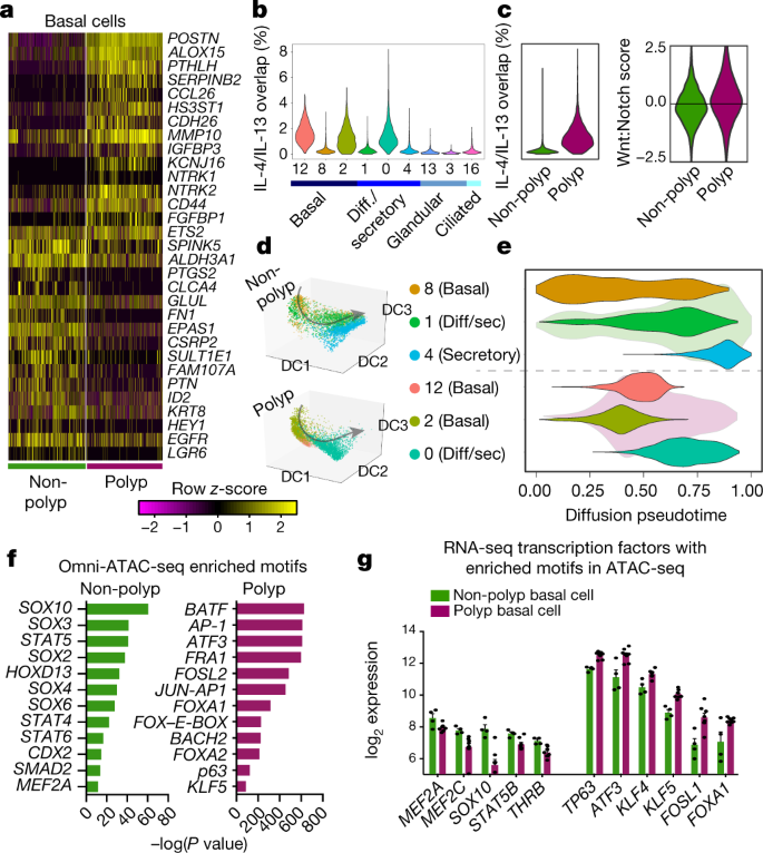 Allergic inflammatory memory in human respiratory epithelial progenitor  cells | Nature