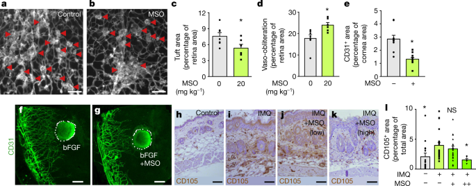 glutathione glutamine synthetase 5 Route of synthesis of (GSH) involving three amino acids Overview of de novo glutathione