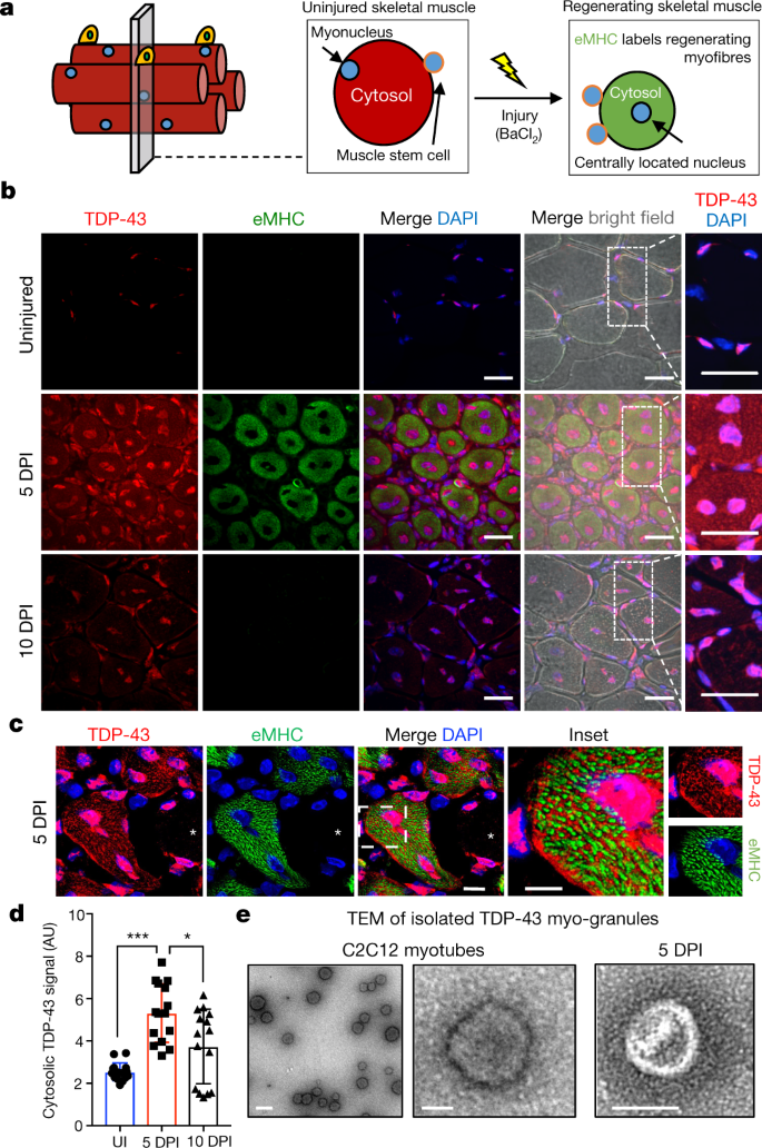 Tdp 43 And Rna Form Amyloid Like Myo Granules In Regenerating Muscle Nature Tdp 43 And Rna Form Amyloid Like Myo Granules In Regenerating Muscle Nature