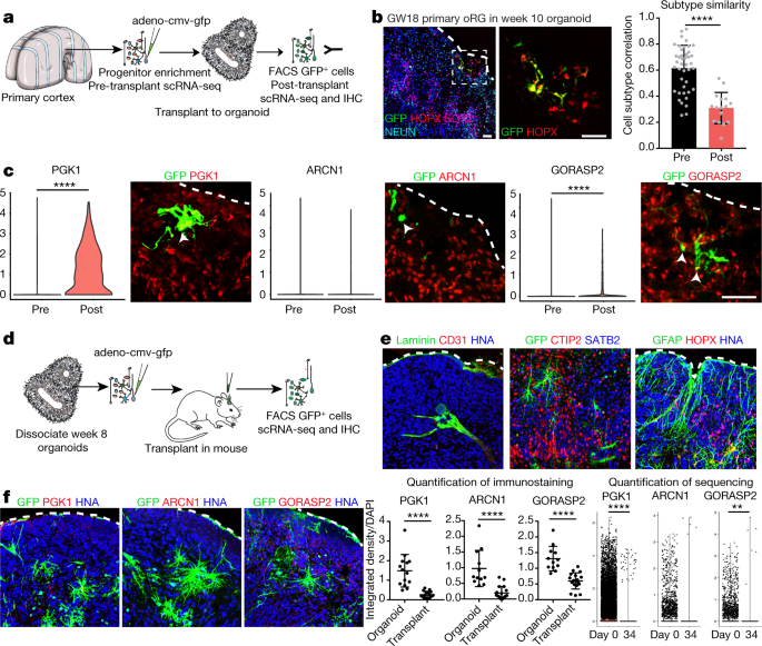 Cell stress in cortical organoids impairs molecular subtype 