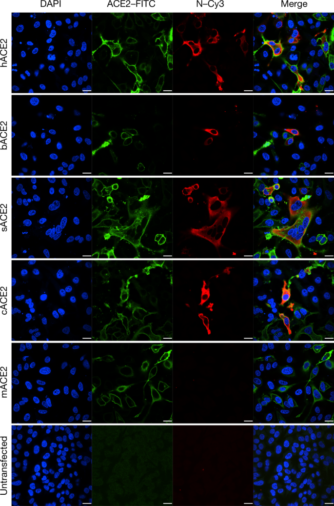 A Pneumonia Outbreak Associated With A New Coronavirus Of Probable Bat Origin Nature