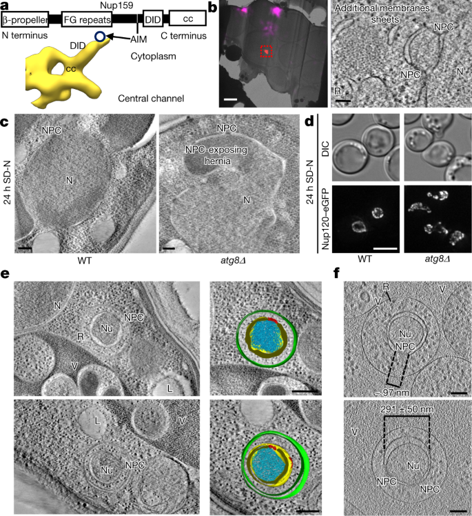 In Cell Architecture Of The Nuclear Pore And Snapshots Of Its Turnover Nature