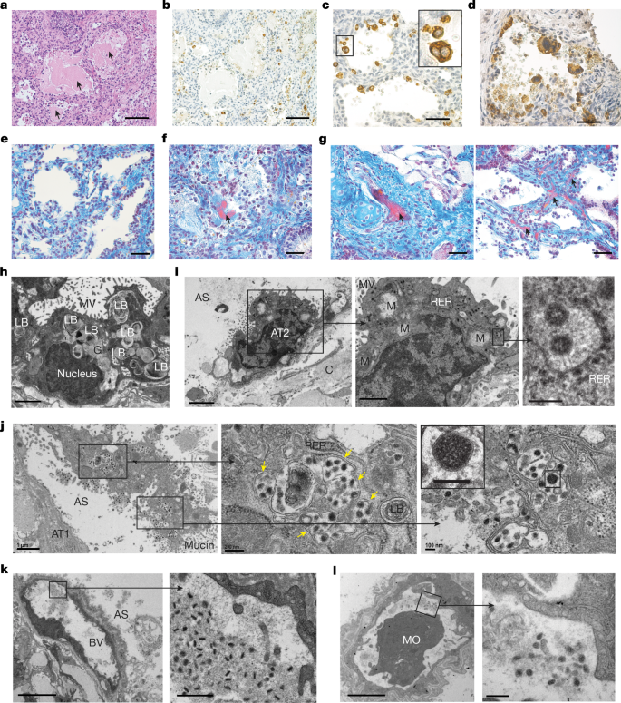 Sars Cov 2 Infection Is Effectively Treated And Prevented By Eidd 2801 Nature