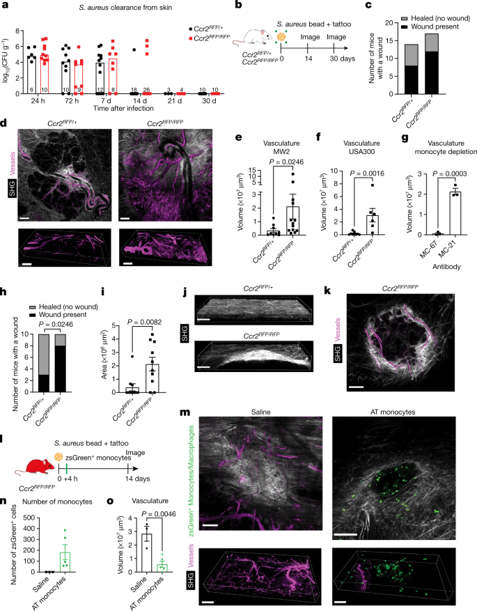 A monocyte–leptin–angiogenesis pathway critical for repair post-infection |  Nature