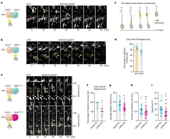 Fig. 4: Deletion of LNPK impairs ER forward migration during nucleokinesis.