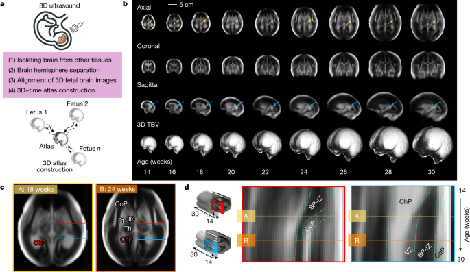 Fig. 1: US-derived, normative atlas of the fetal brain with satisfactory growth and neurodevelopment up to 2 years of age.