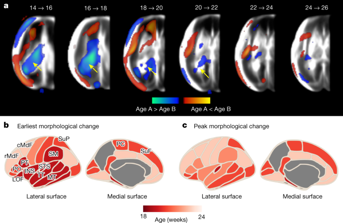 Fig. 4: Timing of the spatiotemporal changes among normative fetuses with satisfactory growth and neurodevelopment until 2 years of age.