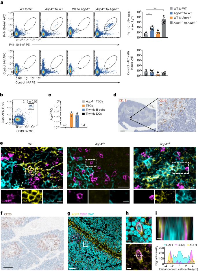 自己免疫疾患の引き金になる可能性が発見される(Possible trigger for autoimmune diseases discovered)