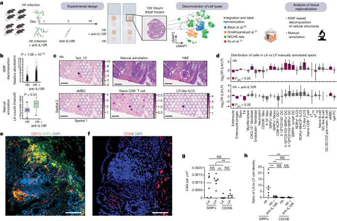 Fig. 4: Enrichment of the LA cell signature by spatial transcriptomics analysis is diminished in inflammation.