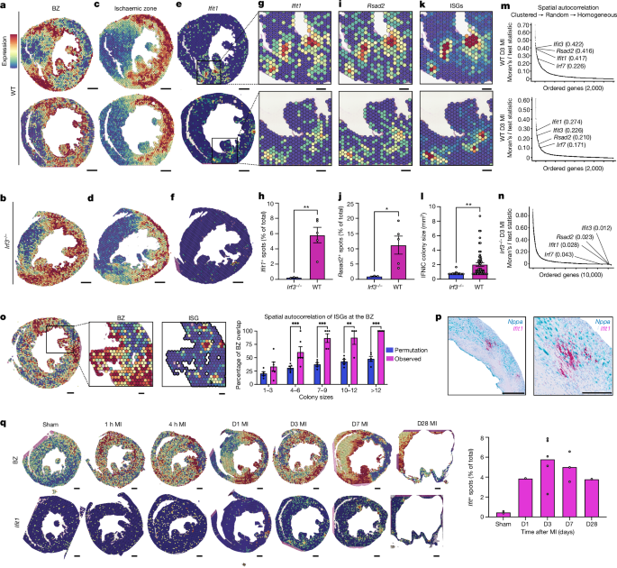 ボーダーゾーンのブレークスルー:心臓炎症の新たな原因(Borderzone Breakthrough: A New Source of Cardiac Inflammation)