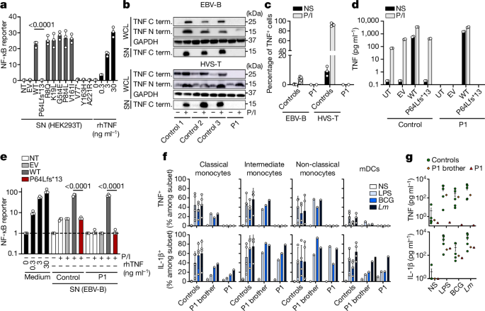 Fig. 2: The patients’ variant results in the loss of TNF production.