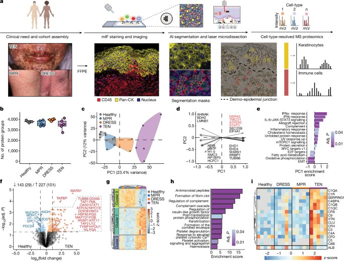 新技術が致死的皮膚反応患者の命を救う(New technology saves the lives of patients with fatal skin reactions)