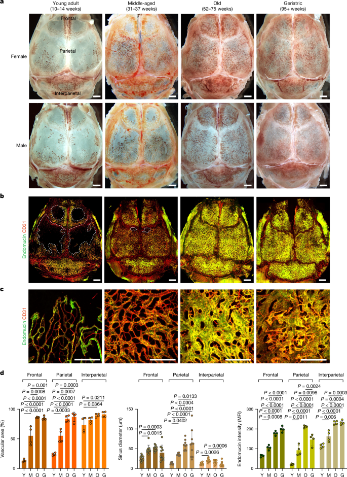 Adult skull bone marrow is an expanding and resilient