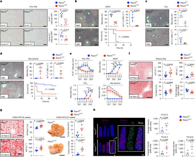 Fig. 4: HSC-derived RSPO3 regulates hepatocyte injury, liver regeneration and steatosis.