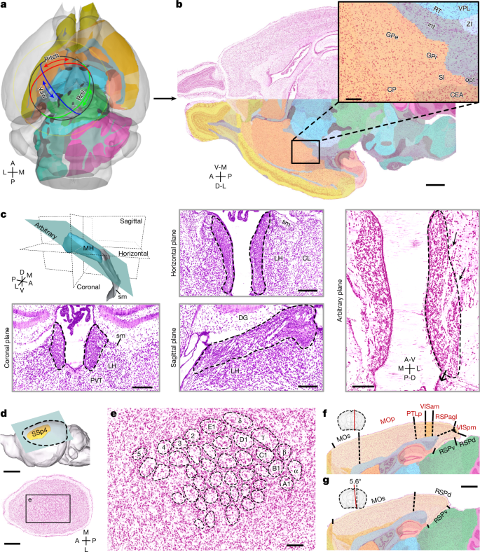 Fig. 4: Arbitrary-angle reslicing of the 3D cytoarchitectural image of STAM with isotropic 1-μm resolution.