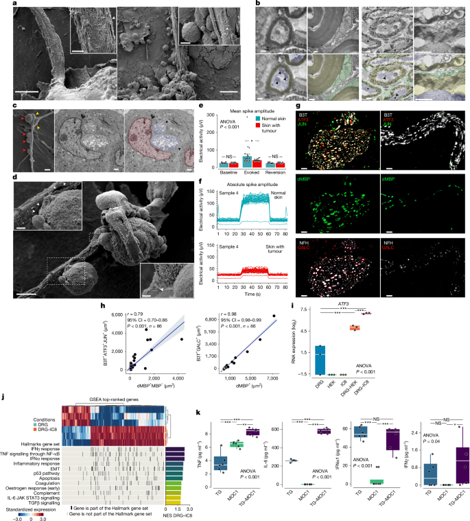 Fig. 2: CINI is driven by myelin degradation, followed by a neuron-driven inflammatory response.