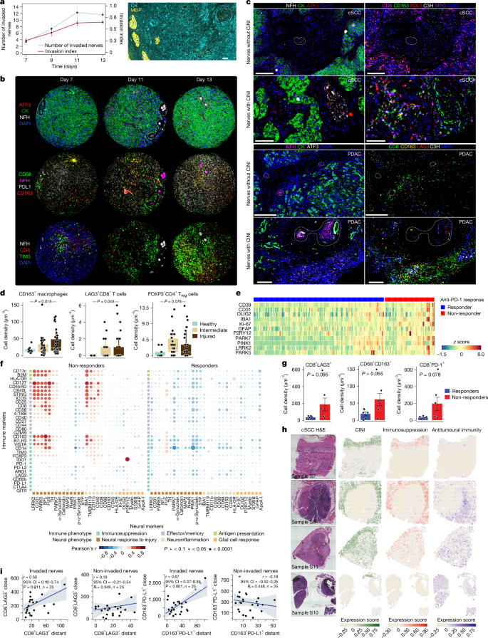 Fig. 3: CINI immunosuppression and immune exhaustion extends beyond the perineural niches into the general tumour microenvironment.