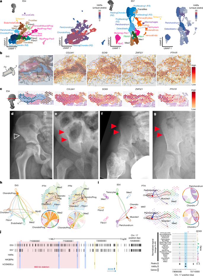 Fig. 2: Genetic architecture of the human iliac growth plate.
