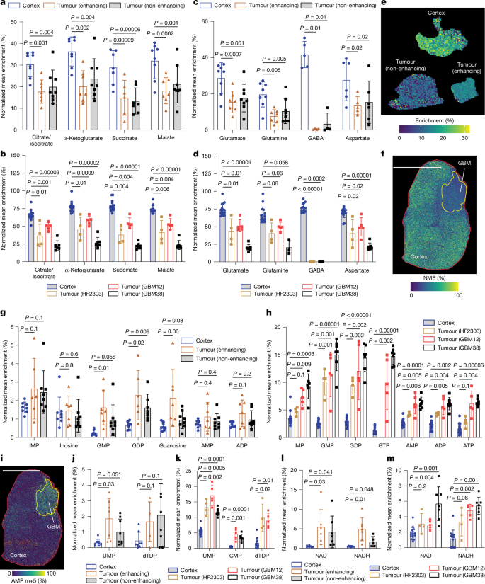 Fig. 2: GBM modulates TCA cycle and neurotransmitters to channel glucose into nucleotides and NAD.