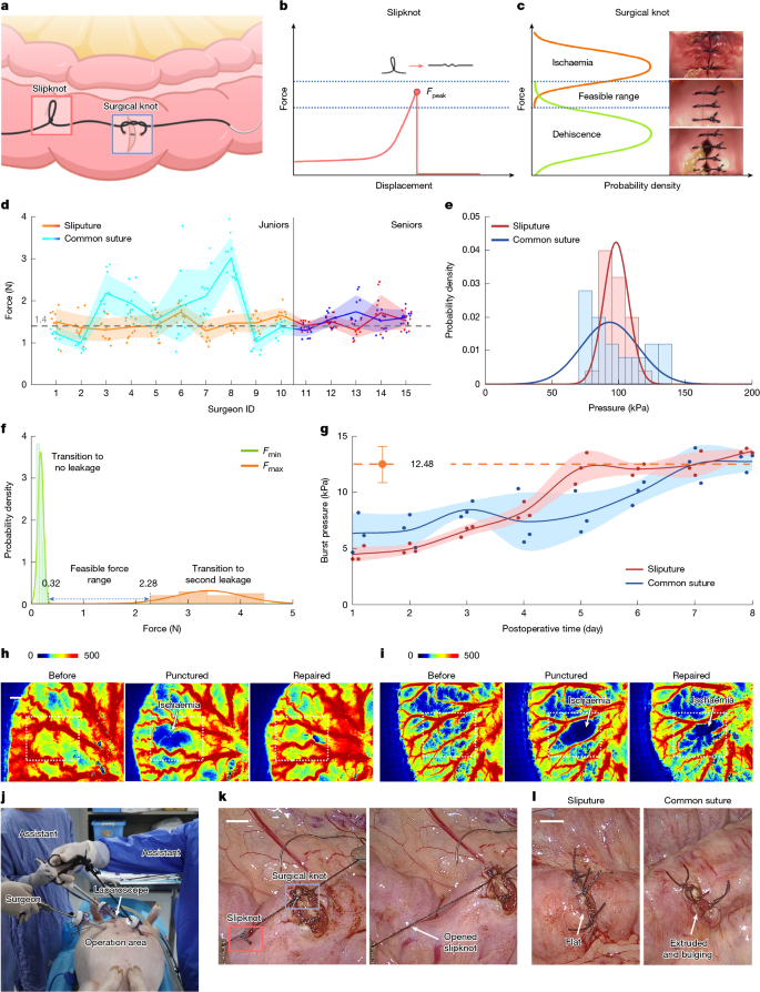Fig. 3: A slipknot gauges mechanical transmission in surgical operations.