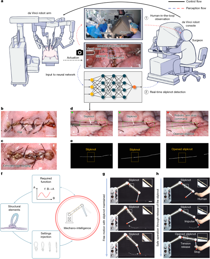 Fig. 4: A slipknot gauges the intelligent operation of robots.