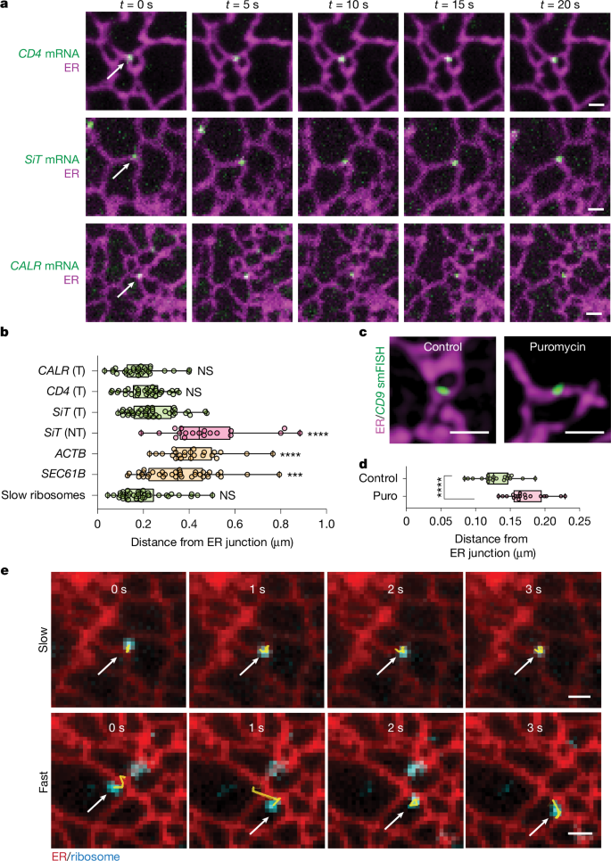 Fig. 2: ER junctions are hotspots for secretome mRNA translation.