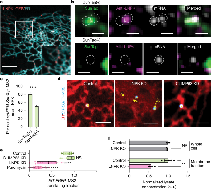 Fig. 3: LNPK marks ER junctions that enhance secretome mRNA translation.