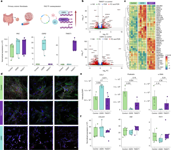 Fig. 2: Developmental transcription factor control of fistula-associated fibroblast functions.