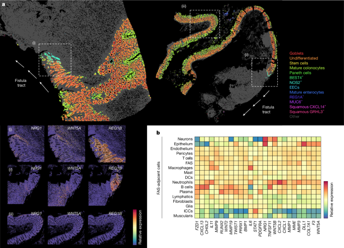Fig. 4: Fibroblast states that support fistula tract epithelialization.