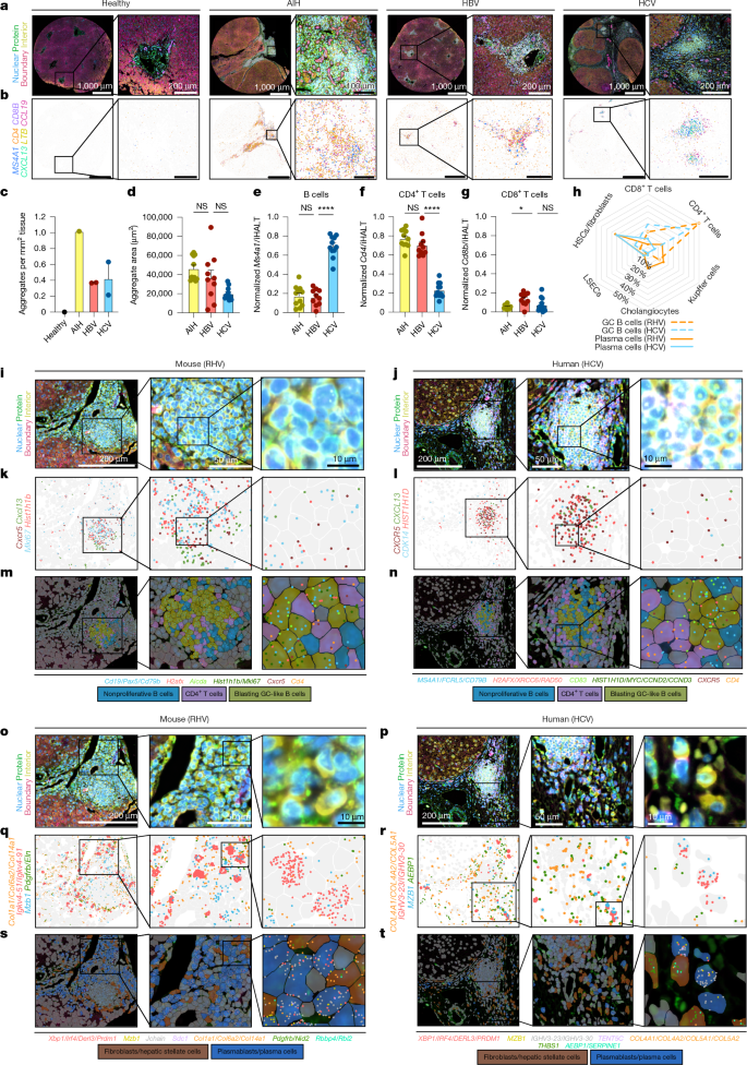 Fig. 5: Hepaciviral infection in mouse and human induce intrahepatic lymphoid structures with highly similar cellular composition, organizational microarchitecture and cell–cell contacts.
