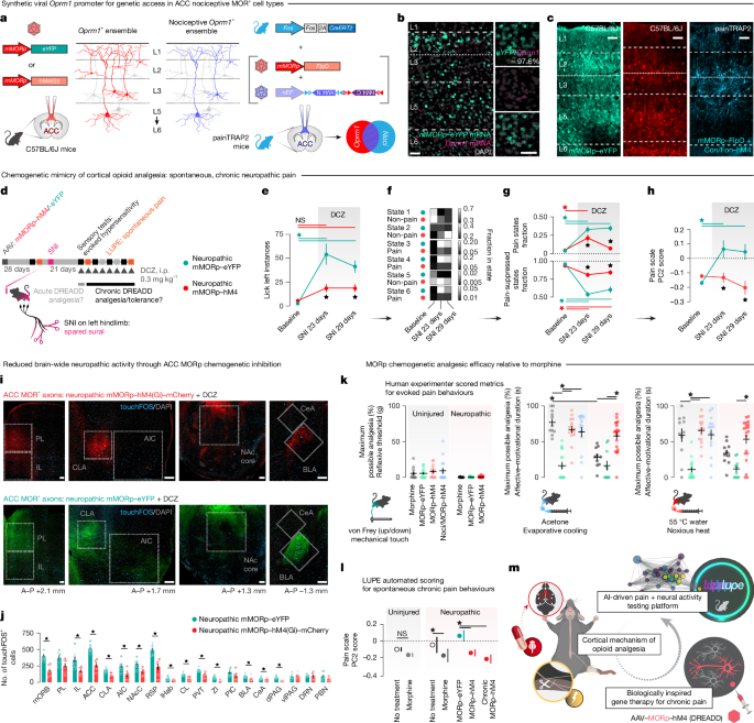 Fig. 4: Precision neuromodulation of chronic pain through an ACC opioid cell-type-specific chemogenetic gene therapy.