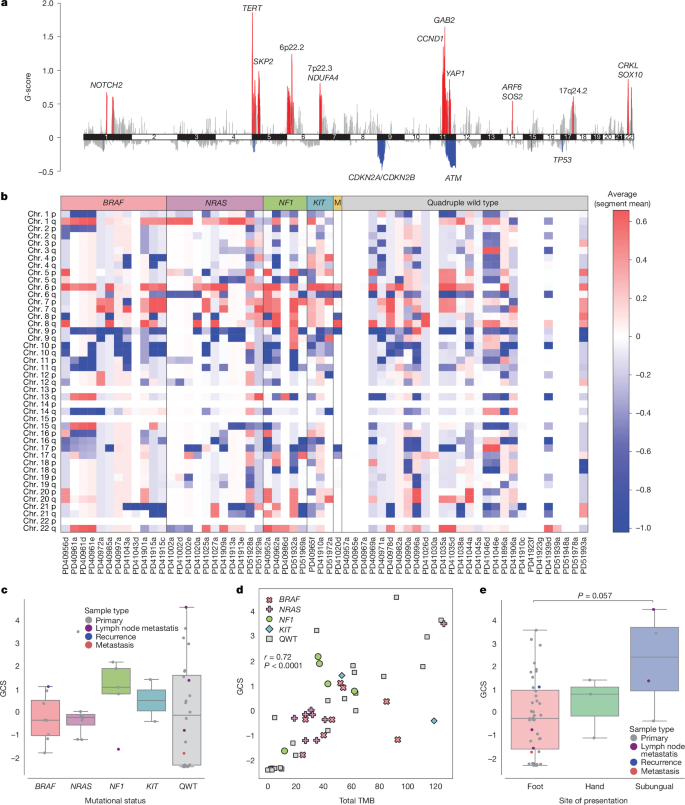 Fig. 2: DNA copy number landscape of acral melanoma and molecular and clinical correlates in Mexican patients.