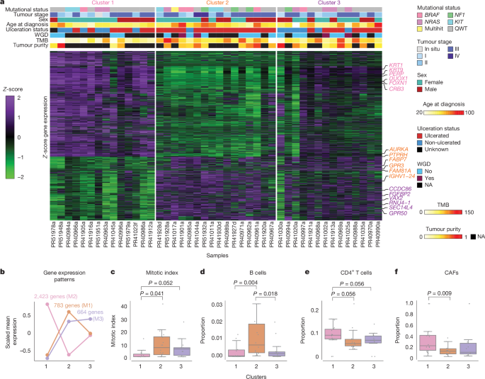Fig. 4: Unsupervised gene expression clustering of primary acral melanoma samples from Mexican patients identifies three main groups.